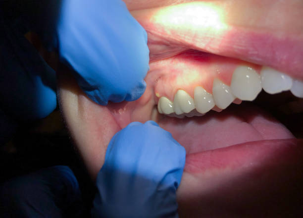 Best Emergency Gum Pain Relief  in Arcola, TX